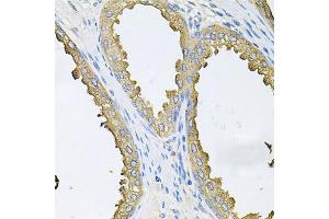 Immunohistochemistry of paraffin-embedded human prostate using ABL1 antibody. (ABL1 Antikörper)