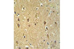 Immunohistochemistry analysis in brain tissue (formalin-fixed, paraffin-embedded) using GPR17 Antibody , followed by peroxidase conjugation of the secondary antibody and DAB staining. (GPR17 Antikörper  (Middle Region))