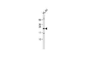 Anti-hCDKN3- at 1:2000 dilution + HL-60 whole cell lysate Lysates/proteins at 20 μg per lane. (CDKN3 Antikörper  (C-Term))