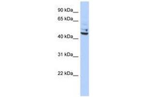Image no. 1 for anti-Tumor Protein P53 Inducible Protein 13 (TP53I13) (C-Term) antibody (ABIN6741108) (TP53I13 Antikörper  (C-Term))