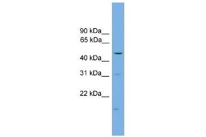 WB Suggested Anti-ARRB1 Antibody Titration:  0. (beta Arrestin 1 Antikörper  (Middle Region))