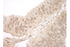 Immunohistochemistry (IHC) image for anti-Junction Mediating and Regulatory Protein, P53 Cofactor (JMY) (AA 1-50) antibody (ABIN7448618)