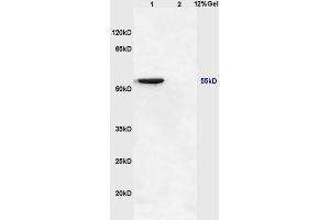 Lane 1: mouse brain lysates Lane 2: mouse heart lysates probed with Anti NFKBIE/IKB epsilon Polyclonal Antibody, Unconjugated (ABIN1386753) at 1:200 in 4 °C. (NFKBIE Antikörper  (AA 165-270))