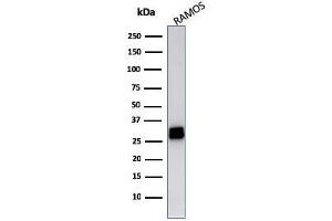 Western Blotting (WB) image for anti-Major Histocompatibility Complex, Class II, DR beta 1 (HLA-DRB1) antibody (ABIN6939640)