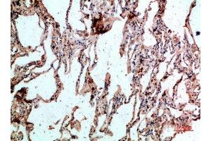 Immunohistochemical analysis of paraffin-embedded human-lung, antibody was diluted at 1:200 (CD236/GYPC Antikörper  (AA 11-60))