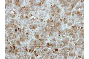 IHC-P Image Immunohistochemical analysis of paraffin-embedded MCF7 xenograft, using TBCK, antibody at 1:100 dilution. (TBCK Antikörper)