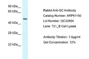 Western Blotting (WB) image for anti-Gc (N-Term) antibody (ABIN2788696) (Gc (N-Term) Antikörper)
