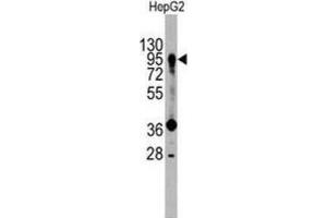 Western Blotting (WB) image for anti-Prospero Homeobox 1 (PROX1) antibody (ABIN3001422) (PROX1 Antikörper)