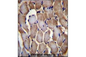 Immunohistochemistry analysis in Formalin Fixed, Paraffin Embedded Human skeletal muscle tissue stained with SEPN1 antibody (C-term) followed by peroxidase conjugation of the secondary antibody and DAB staining. (SEPN1 Antikörper  (C-Term))