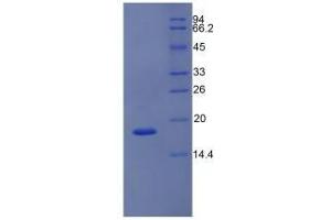 SDS-PAGE analysis of Mouse NOS1 Protein. (NOS1 Protein)
