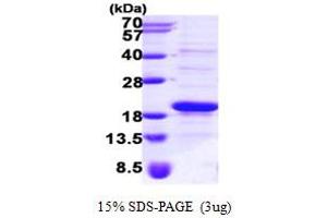 SDS-PAGE (SDS) image for Signal Recognition Particle 14kDa (Homologous Alu RNA Binding Protein) (SRP14) (AA 1-136) protein (His tag) (ABIN667276) (SRP14 Protein (AA 1-136) (His tag))