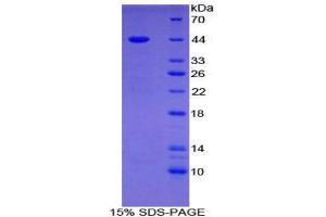 SDS-PAGE (SDS) image for Gastrin (GAST) (AA 1-101) protein (His tag,GST tag) (ABIN2122891) (Gastrin Protein (GAST) (AA 1-101) (His tag,GST tag))