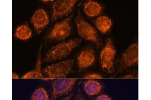 Immunofluorescence analysis of HeLa cells using MTMR9 Polyclonal Antibody at dilution of 1:100. (MTMR9 Antikörper)