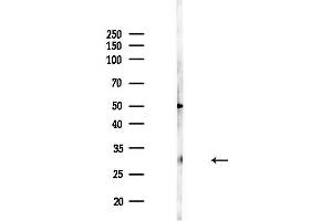 anti-Insulin-Like Growth Factor Binding Protein 6 (IGFBP6) (Internal Region) antibody