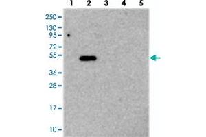 Western blot analysis of Lane 1: RT-4, Lane 2: U-251 MG, Lane 3: Human Plasma, Lane 4: Liver, Lane 5: Tonsil with TMEM39A polyclonal antibody  at 1:250-1:500 dilution. (TMEM39A Antikörper)