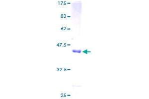 Image no. 1 for Serine/threonine Kinase 10 (STK10-A) (AA 12-144) protein (GST tag) (ABIN1321647) (STK10-A Protein (AA 12-144) (GST tag))