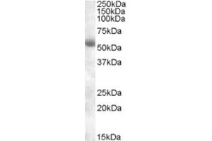 Western Blotting (WB) image for anti-Transmembrane Protease, serine 2 (TMPRSS2) (Internal Region) antibody (ABIN2466752) (TMPRSS2 Antikörper  (Internal Region))