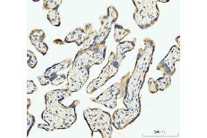 IHC analysis of DHODH using anti-DHODH antibody (ABIN7603139). (DHODH Antikörper  (N-Term))