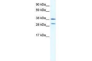WB Suggested Anti-NKX2-3 Antibody Titration:  0. (NK2 Homeobox 3 Antikörper  (N-Term))