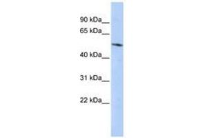 BCL6B Antikörper  (C-Term)