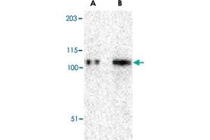 Western blot analysis of TRPC6 in K-562 cell lysate with TRPC6 polyclonal antibody  at (A) 0. (TRPC6 Antikörper  (N-Term))