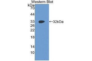Western Blotting (WB) image for anti-Insulin-Like Growth Factor 2 mRNA Binding Protein 2 (IGF2BP2) (AA 141-384) antibody (ABIN1859297) (IGF2BP2 Antikörper  (AA 141-384))