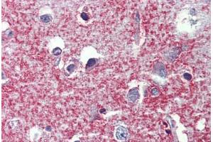 Human Brain, cortex: Formalin-Fixed, Paraffin-Embedded (FFPE) (SHROOM2 Antikörper  (AA 1554-1616))