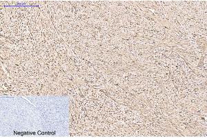 anti-Peroxiredoxin 1 (PRDX1) antibody