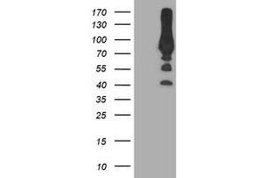 Western Blotting (WB) image for anti-phosphofructokinase, Platelet (PFKP) antibody (ABIN1500165) (PFKP Antikörper)