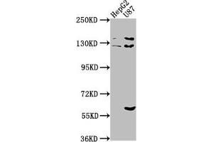 Western Blot Positive WB detected in: HepG2 whole cell lysate, U87 whole cell lysate All lanes: ST5 antibody at 1:2000 Secondary Goat polyclonal to rabbit IgG at 1/50000 dilution Predicted band size: 127, 83, 71 kDa Observed band size: 127 kDa (ST5 Antikörper  (AA 3-280))