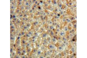 Used in DAB staining on fromalin fixed paraffin-embedded Liver tissue (SERPINB3 Antikörper  (AA 1-210))