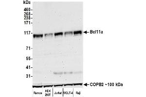 Western Blotting (WB) image for anti-B-Cell CLL/lymphoma 11A (Zinc Finger Protein) (BCL11A) (AA 1-50) antibody (ABIN7453321)