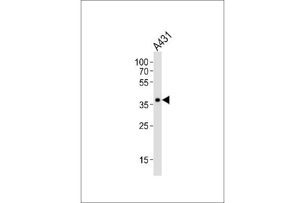 MUL1 Antikörper  (AA 176-210)