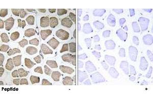 Immunohistochemistry analysis of paraffin-embedded human skeletal muscle tissue using SLC16A12 polyclonal antibody . (SLC16A12 Antikörper)