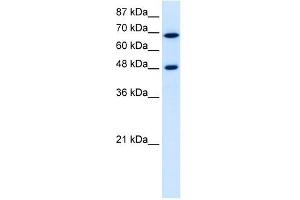 RRP9 antibody used at 5 ug/ml to detect target protein. (RRP9 Antikörper  (Middle Region))