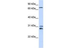 Image no. 1 for anti-Tousled-Like Kinase 2 (TLK2) (AA 176-225) antibody (ABIN6744261) (TLK2 Antikörper  (AA 176-225))