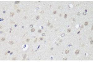 Immunohistochemistry of paraffin-embedded Rat brain using CTCF Polyclonal Antibody at dilution of 1:200 (40x lens). (CTCF Antikörper)