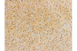 ABIN6257890 and ABIN6274946 at 1/100 staining Rat brain tissue by IHC-P. (CAGE1 Antikörper  (C-Term))