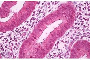 Anti-GALNT7 antibody IHC staining of human uterus, endometrium. (GALNT7 Antikörper)