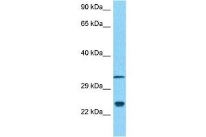 Host:  Rabbit  Target Name:  NCS1  Sample Type:  MDA-MB-435s Whole Cell lysates  Antibody Dilution:  1.