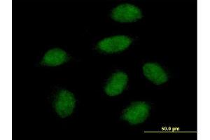 Immunofluorescence of purified MaxPab antibody to SNAI1 on HeLa cell.