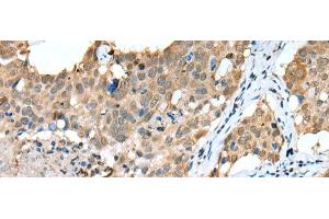 Immunohistochemistry (Paraffin-embedded Sections) (IHC (p)) image for anti-Sprouty RTK Signaling Antagonist 4 (SPRY4) antibody (ABIN7251967)