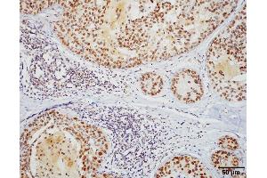 Immunohistochemistry (IHC) image for anti-Heat Shock Factor Protein 1 (HSF1) (AA 378-395) antibody (Atto 594) (ABIN2484620)