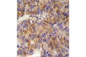 Immunohistochemistry (Paraffin-embedded Sections) (IHC (p)) image for anti-Multiple Inositol-Polyphosphate Phosphatase 1 (MINPP1) (AA 35-63), (N-Term) antibody (ABIN953449)