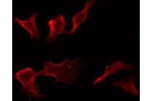 Immunofluorescence (fixed cells) (IF/ICC) image for anti-Fc Fragment of IgG, Low Affinity IIc, Receptor For (CD32) (FCGR2C) (C-Term) antibody (ABIN6259531)
