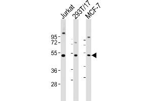 All lanes : Anti-VRK1 antibody at 1:2000 dilution Lane 1: Jurkat whole cell lysates Lane 2: 293T/17 whole cell lysates Lane 3: MCF-7 whole cell lysates Lysates/proteins at 20 μg per lane. (VRK1 Antikörper  (AA 366-396))