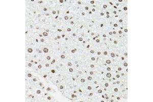 Immunohistochemistry (Paraffin-embedded Sections) (IHC (p)) image for anti-Endothelial Differentiation Related Factor 1 (EDF1) (AA 1-148) antibody (ABIN1679646)