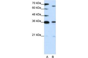Western Blotting (WB) image for anti-PR Domain Containing 13 (PRDM13) antibody (ABIN2461914) (PRDM13 Antikörper)