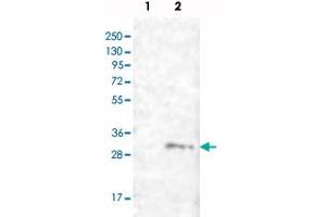 Western blot analysis of Lane 1: Negative control (vector only transfected HEK293T lysate), Lane 2: Over-expression lysate (Co-expressed with a C-terminal myc-DDK tag (~3. (FAM82B Antikörper)