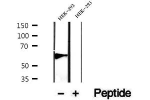 Western blot analysis of extracts of HEK-293 cells, using PHF17 antibody. (PHF17 Antikörper  (C-Term))
